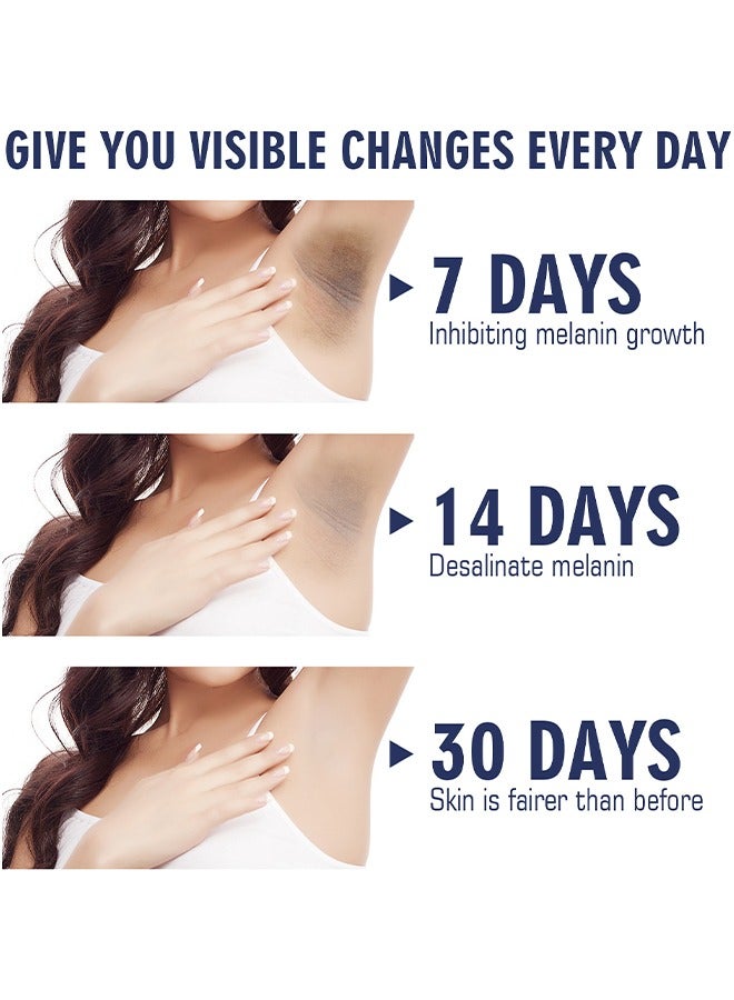 Ouhoe Whitening Cream for Sensitive Areas