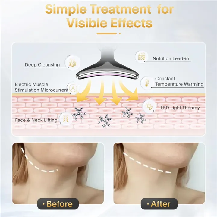 Anti Wrinkle Facial Massager Skin